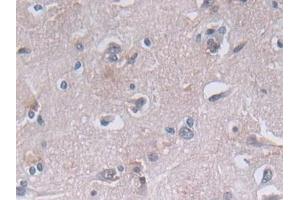 Immunohistochemistry (IHC) image for anti-Phosphoglycerate Kinase 1 (PGK1) (AA 2-417) antibody (ABIN7436240)