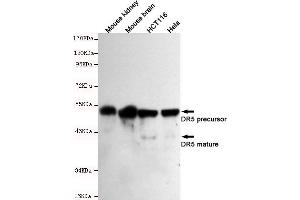 Western blot detection of DR5 in Mouse kindey,Mouse brain,HC and Hela cell lysates using DR5 mouse mAb (1:500-1:2000 diluted). (TNFRSF10B Antikörper)