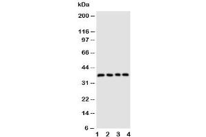 Western blot testing of CD1d antibody and Lane 1:  COLO320 (CD1d Antikörper  (AA 76-92))