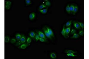 Immunofluorescence staining of HepG2 cells with ABIN7163307 at 1:66, counter-stained with DAPI. (PIRT Antikörper  (AA 1-55))