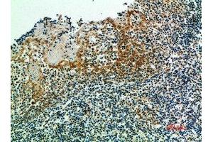 Immunohistochemical analysis of paraffin-embedded human-tonsils, antibody was diluted at 1:200 (IRF3 Antikörper  (AA 1268-1341))
