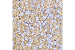 Immunohistochemistry (IHC) image for anti-Synaptosomal-Associated Protein, 25kDa (SNAP25) (AA 1-206) antibody (ABIN3021232)