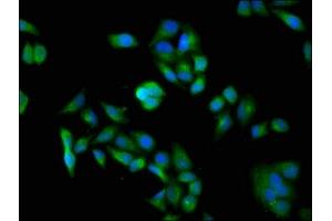 Immunofluorescence staining of Hela cells with ABIN7150124 at 1:100, counter-stained with DAPI. (DDB1 Antikörper  (AA 741-943))
