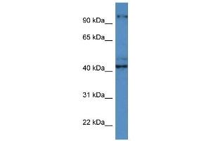 Western Blot showing ATCAY antibody used at a concentration of 1 ug/ml against ACHN Cell Lysate