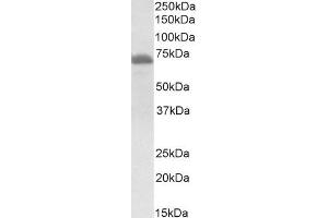 Western Blotting (WB) image for anti-Craniofacial Development Protein 1 (CFDP1) (Middle Region) antibody (ABIN2774005)