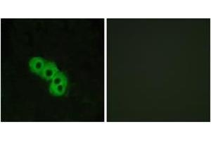 Immunofluorescence analysis of MCF7 cells, using GPR109 Antibody.