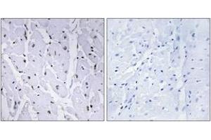 Immunohistochemistry analysis of paraffin-embedded human heart, using MYB (Phospho-Ser12) Antibody. (MYB Antikörper  (pSer12))