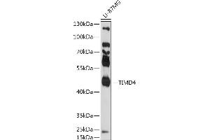 Western blot analysis of extracts of U-87MG cells, using TIMD4 antibody (ABIN7270705) at 1:1000 dilution. (TIMD4 Antikörper  (AA 25-130))