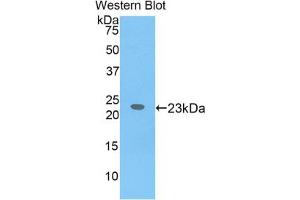 Western blot analysis of the recombinant protein. (IL17 Receptor B Antikörper  (AA 310-499))
