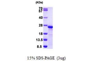 SDS-PAGE (SDS) image for Myosin Regulatory Light Chain 2, Smooth Muscle Isoform (MYL9) (AA 1-172) protein (His tag) (ABIN667358) (MYL9 Protein (AA 1-172) (His tag))