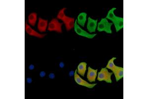 ABIN7096241 and ABIN7100303 staining Hela cells by IF/ICC. (SAMD3 Antikörper)