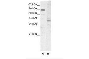 Image no. 1 for anti-LIM Homeobox 2 (LHX2) (AA 251-300) antibody (ABIN202444)