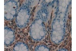 Immunohistochemistry (IHC) image for anti-Lectin, Galactoside-Binding, Soluble, 1 (LGALS1) (AA 1-135) antibody (ABIN7431629)