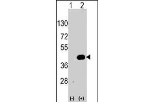 Western blot analysis of WIF1 (arrow) using WIF1 polyclonal antibody . (WIF1 Antikörper  (AA 350-379))