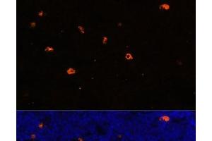 Immunofluorescence analysis of Rat bone marrow using CAMP Polyclonal Antibody at dilution of 1:100. (Cathelicidin Antikörper)