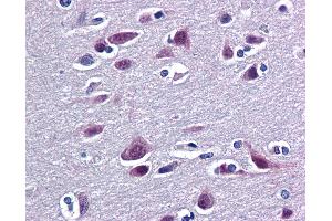 anti-RNA Binding Motif Protein 9 (RBM9) (AA 1-100) antibody