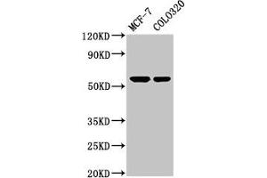 Western Blot Positive WB detected in: MCF-7 whole cell lysate, Colo320 whole cell lysate All lanes: MYOC antibody at 5. (MYOC Antikörper  (AA 183-294))