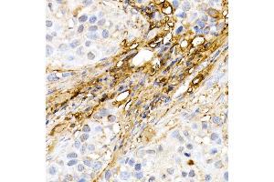 Immunohistochemistry of paraffin-embedded human colon using ASC/TMS1 Rabbit pAb (ABIN6131200, ABIN6146515, ABIN6146516 and ABIN6215212) at dilution of 1:150 (40x lens). (PYCARD Antikörper  (AA 50-195))
