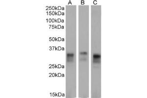 Western Blot using anti-major Prion protein antibody 3F4. (Rekombinanter PRNP Antikörper)