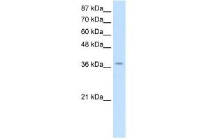 ZNF550 antibody (20R-1242) used at 0. (ZNF550 Antikörper  (Middle Region))