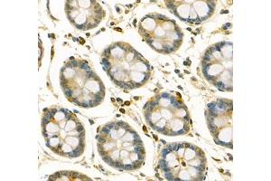 Immunohistochemistry of paraffin embedded human colon using ANXA3 (ABIN7073065) at dilution of 1: 200 (400x lens) (Annexin A3 Antikörper)