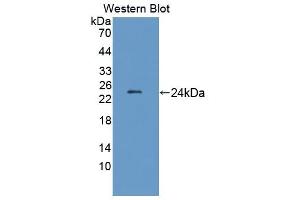 Detection of Recombinant LAMb2, Rat using Polyclonal Antibody to Laminin Beta 2 (LAMb2) (LAMB2 Antikörper  (AA 939-1129))