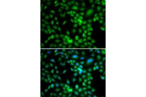Immunofluorescence analysis of MCF7 cell using SYCE1 antibody. (SYCE1 Antikörper)