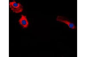 Immunofluorescent analysis of Gastrin staining in HeLa cells. (Gastrin Antikörper  (Center))