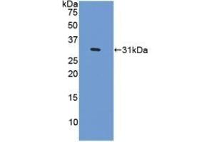 Detection of Recombinant CENPI, Human using Polyclonal Antibody to Centromere Protein I (CENPI) (CENPI Antikörper  (AA 292-528))