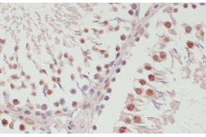 Immunohistochemistry of paraffin-embedded Rat testis using SNRNP70 Polyclonal Antibody at dilution of 1:100 (40x lens). (SNRNP70 Antikörper)