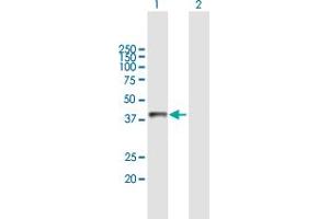 Western Blot analysis of ASGR2 expression in transfected 293T cell line by ASGR2 MaxPab polyclonal antibody. (Asialoglycoprotein Receptor 2 Antikörper  (AA 1-287))