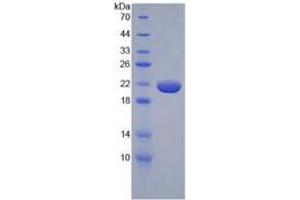 SDS-PAGE (SDS) image for Tumor Necrosis Factor alpha (TNF alpha) ELISA Kit (ABIN6574140)