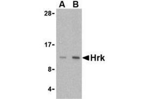 Western blot analysis of Hrk in mouse pancreas tissue lysate with AP30395PU-N Hrk antibody at (A) 2. (HRK Antikörper  (Center))