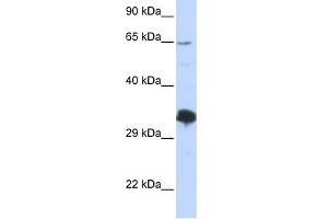 WB Suggested Anti-ZNF630 Antibody Titration:  0. (ZNF630 Antikörper  (Middle Region))