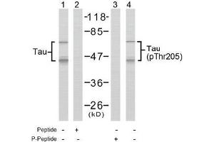 Image no. 2 for anti-Microtubule-Associated Protein tau (MAPT) (pThr205) antibody (ABIN196803) (MAPT Antikörper  (pThr205))
