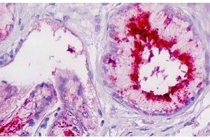 Human Pancreatic Duct: Formalin-Fixed, Paraffin-Embedded (FFPE) (PLA2G7 Antikörper)