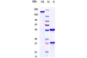 Anti-Mesothelin Reference Antibody (amatuximab) on SDS-PAGE under reducing (R) condition. (Rekombinanter Mesothelin (Amatuximab Biosimilar) Antikörper)