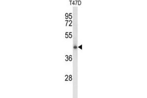 Western Blotting (WB) image for anti-Ceroid-Lipofuscinosis, Neuronal 5 (CLN5) antibody (ABIN3003962) (CLN5 Antikörper)