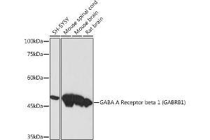 Western blot analysis of extracts of various cell lines, using GABA A Receptor beta 1 (G) (G) Rabbit mAb (ABIN7267345) at 1:1000 dilution. (GABRB1 Antikörper)