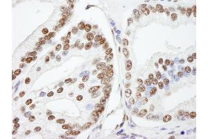 anti-Nuclear Casein Kinase and Cyclin-Dependent Kinase Substrate 1 (NUCKS1) (AA 1-50) antibody
