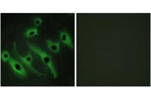 Immunofluorescence analysis of HeLa cells, using HER2 Antibody. (ErbB2/Her2 Antikörper  (AA 641-690))