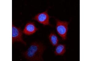 IF analysis of Fibrinogen beta chain/FGB using anti-Fibrinogen beta chain/FGB antibody (ABIN4886579). (Fibrinogen beta Chain Antikörper  (Middle Region))