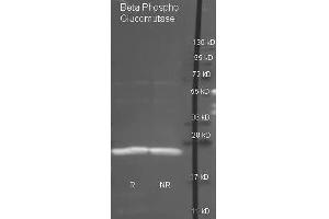 Goat anti antibody  was used to detect purified Beta Phospho Glucomutase under reducing (R) and non-reducing (NR) conditions. (Beta-Phosphoglucomutase Antikörper  (Biotin))