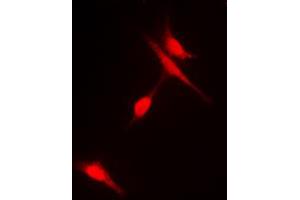 Immunofluorescent analysis of Histone Deacetylase 6 (pS22) staining in Hela cells.