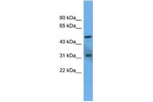 WB Suggested Anti-ADCYAP1R1 Antibody Titration: 0.