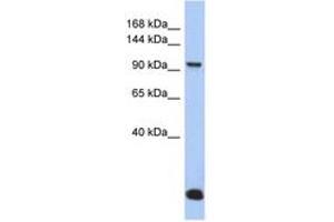 Image no. 1 for anti-Major Vault Protein (MVP) (N-Term) antibody (ABIN6744297) (MVP Antikörper  (N-Term))