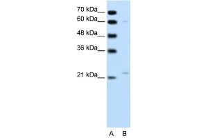 RGS4 antibody used at 1 ug/ml to detect target protein. (RGS4 Antikörper  (C-Term))