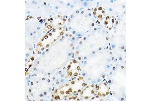 Immunohistochemistry of paraffin-embedded rat kidney using NR5 Rabbit pAb (ABIN6127421, ABIN6144833, ABIN6144835 and ABIN6221444) at dilution of 1:100 (40x lens). (NR5A2 + LRH1 Antikörper  (AA 206-495))