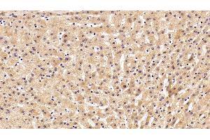 Immunohistochemistry (IHC) image for anti-Transferrin (TF) (AA 361-683) antibody (ABIN7429184)