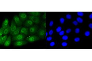 HepG2 cells were stained with Smad5(S463/465) (1B8) Monoclonal Antibody  at [1:200] incubated overnight at 4C, followed by secondary antibody incubation, DAPI staining of the nuclei and detection.
